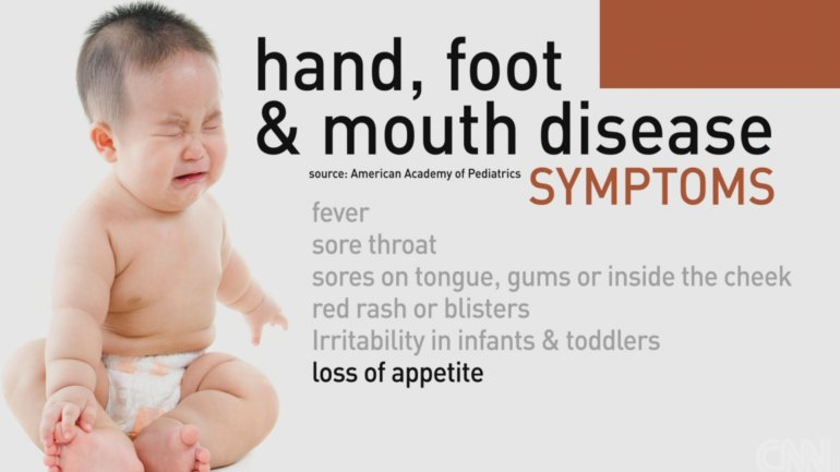 Prevention of Hand-Foot -and- Mouth Disease (HFMD)