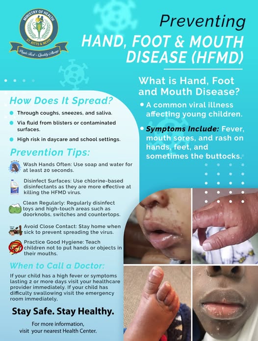 Outbreak of Hand, Foot, and Mouth Disease